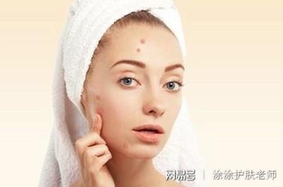 什么可以克制痘痘