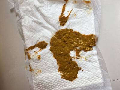 宝宝大便肥皂条怎么用