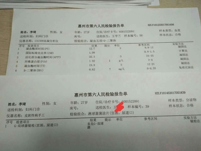 怀孕染色体怎么检查