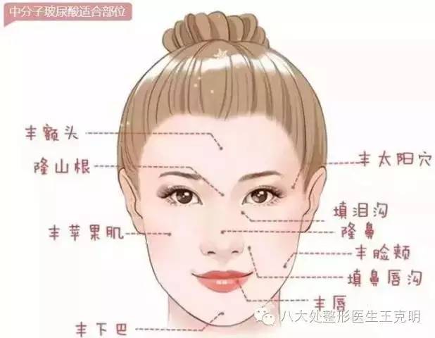 玻尿酸适合什么皮肤