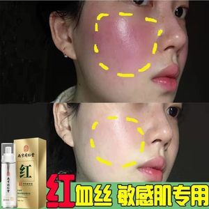 脸部角质层增厚