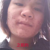 南宁看痘痘喝中药