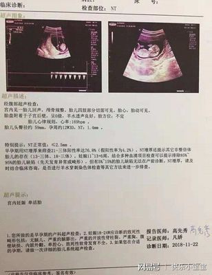 卵泡长不大会怀孕吗