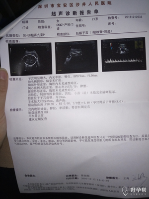2015年深圳妇幼医院剖腹产多少