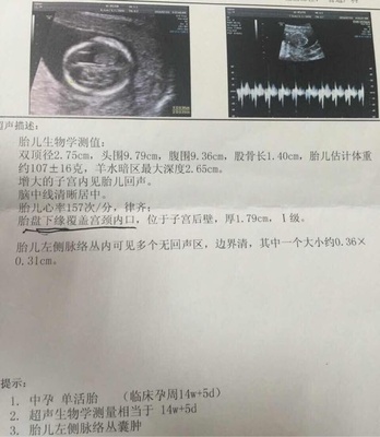 怀孕14周宝宝有多大