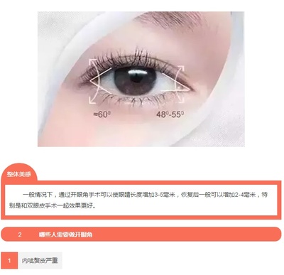 内眦赘皮双眼皮