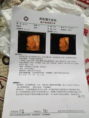 怀孕36周脐带绕颈两周怎么办