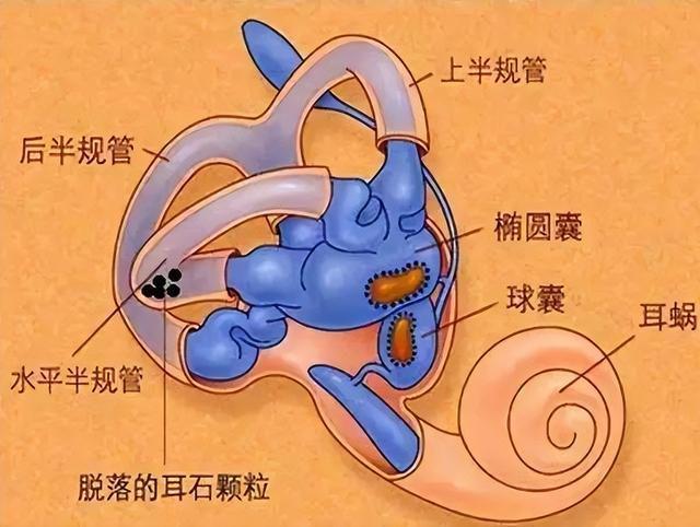 前庭功能眩晕怎么治疗