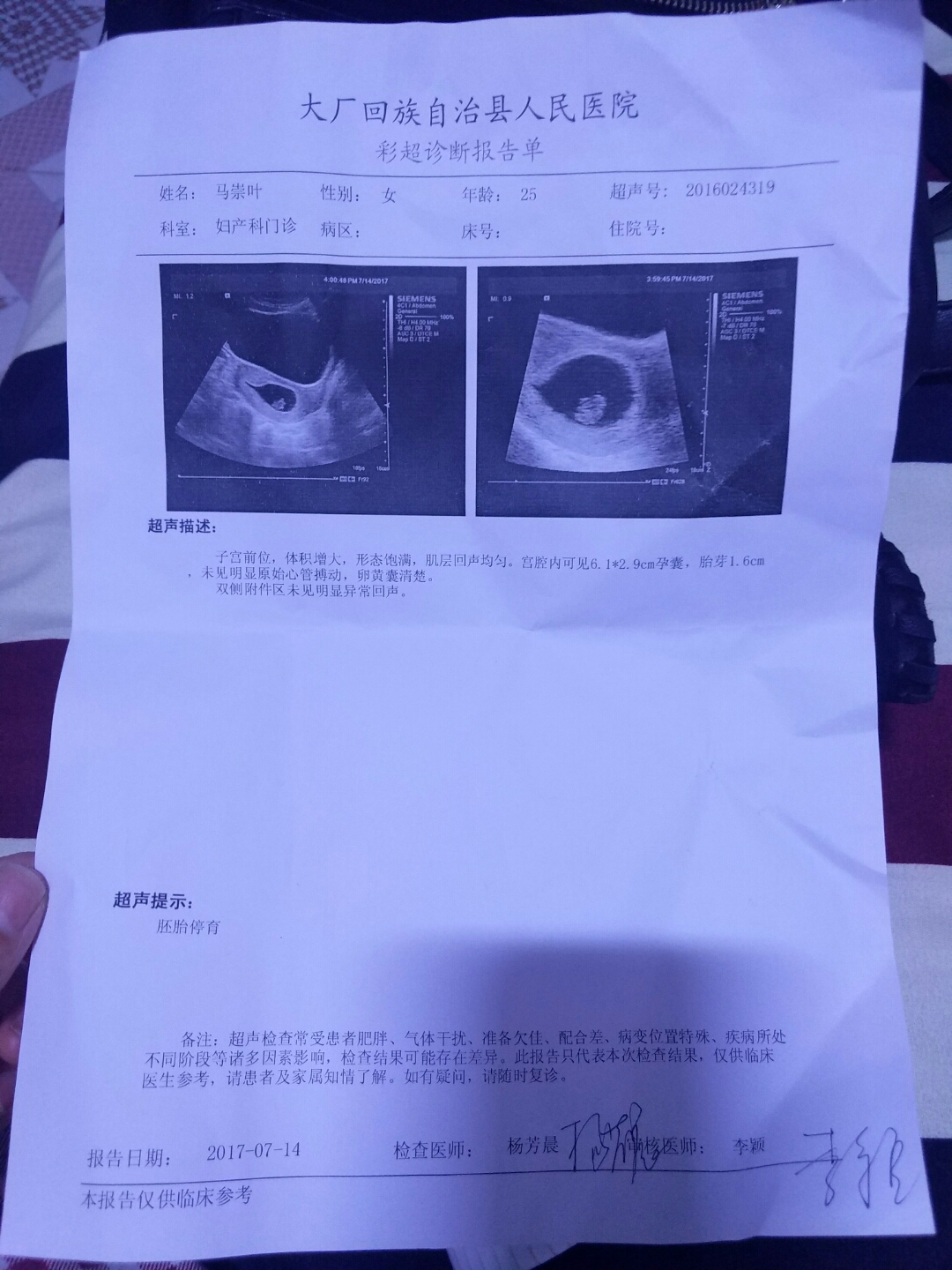 胎儿10周有多大
