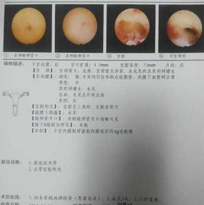 宫腔镜检查疼吗多少钱