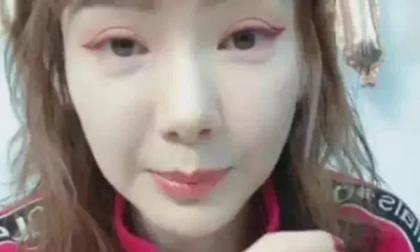 割完双眼皮肉条没知觉