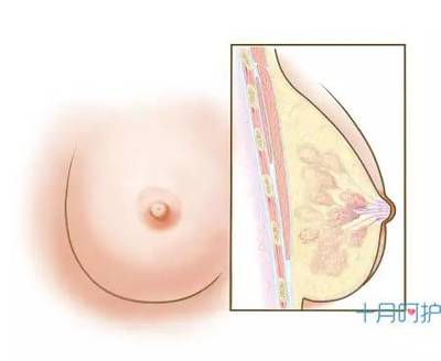 乳腺扩张是怎么回事