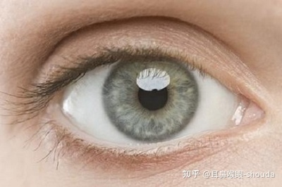 眼真菌感染怎么治疗