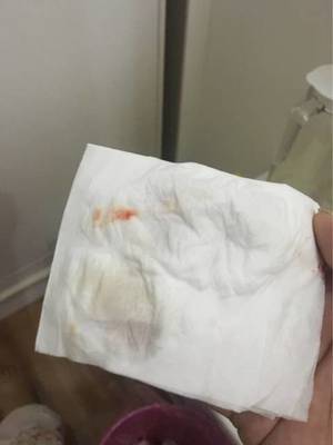 来月经的时候有血块是怎么回事