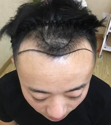 头顶没头发怎么做发型