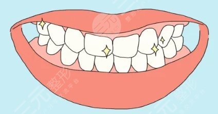 刚做完牙齿矫正吃什么