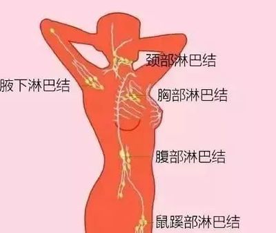 腹部淋巴结怎么治疗才能消除