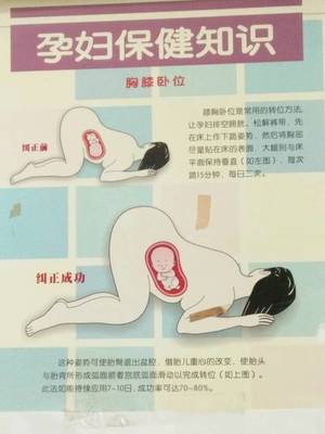 怀孕臀位怎么办