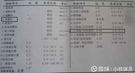 尿液含量多少是正常