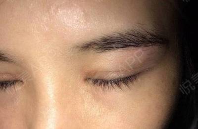双眼皮闭眼照
