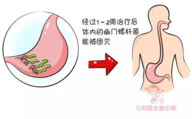 宝宝幽门螺旋杆菌