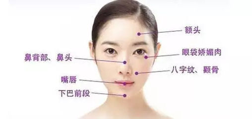 面部激光美白