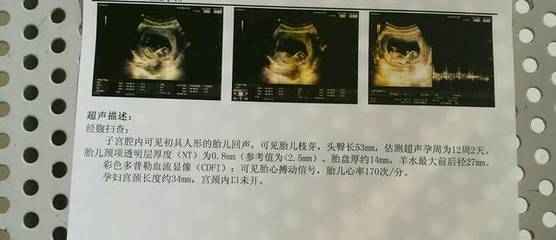 怎么测试男女宝宝最准