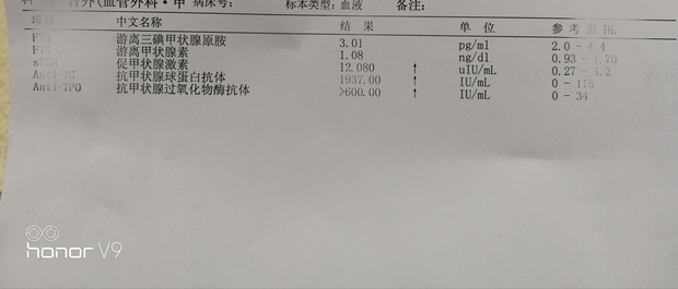 抗甲状腺球蛋白抗体高是怎么回事