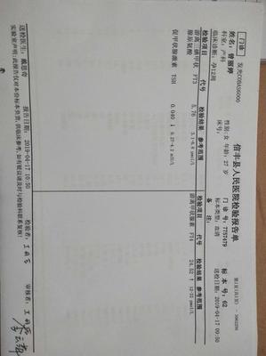 甲状腺偏小是怎么回事