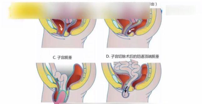 看子宫