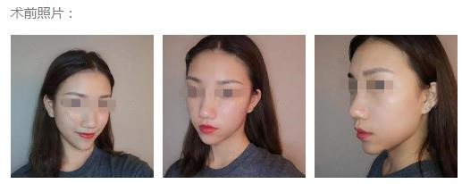 测测你是什么脸型拍照