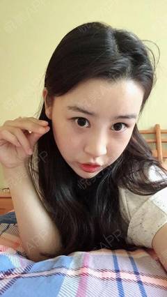 沈阳超声刀除皱