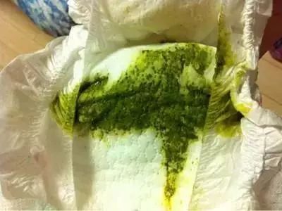 宝宝大便绿色是怎么回事