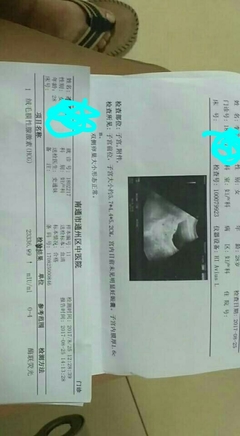 女生两个月来一次月经正常吗
