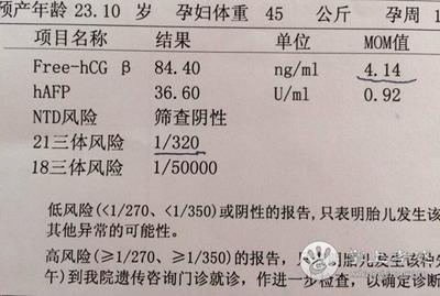 做唐氏一般多少钱