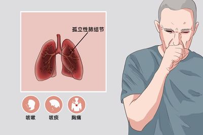 肺结节是怎么回事