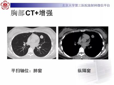 肺部ct多少张图像