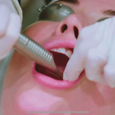 水激光口腔黏膜科