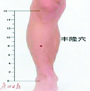 子宫多囊