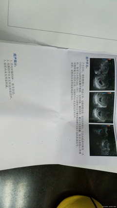 怀孕6周是多少天了