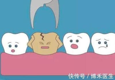 智齿拔牙疼吗