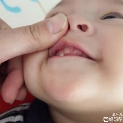 5个多月宝宝长牙正常吗