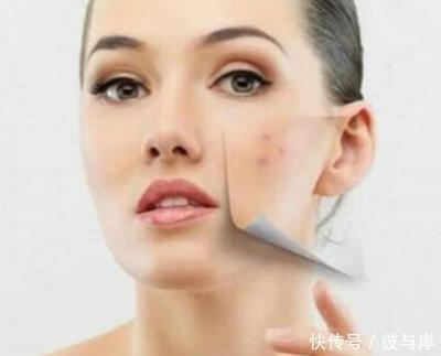 隆起的大痘痘