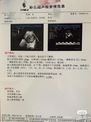 孕32周出血是怎么回事