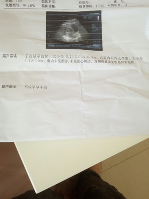 怀孕4周会恶心吗