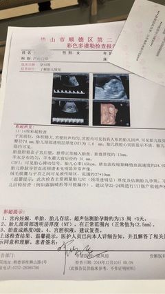 怀孕多久做nt和唐筛