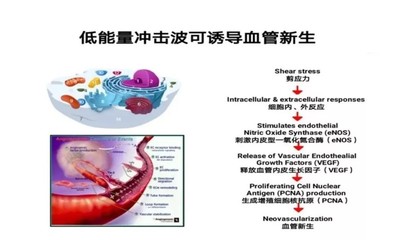 海绵体上血管硬化 做手术多少钱