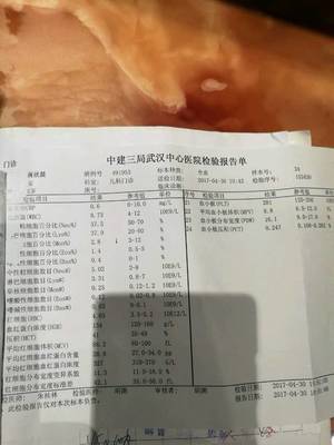 小儿支原体咳嗽反复怎么根治