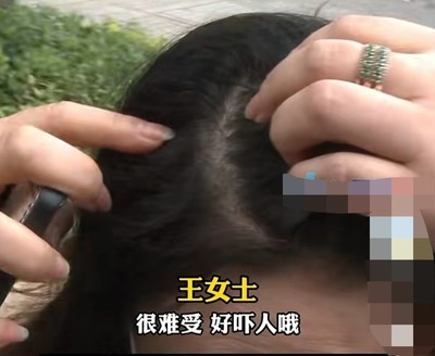 做梦头发断了