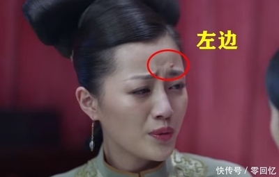 身上长痦子是怎么回事